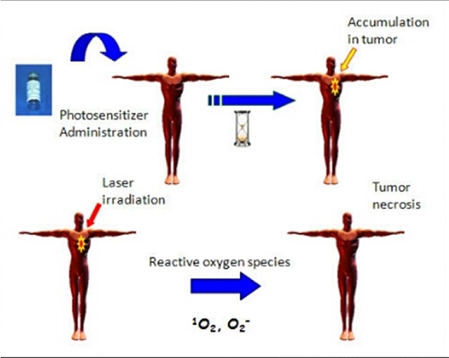 photodynamic therapy1