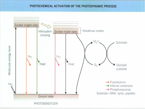 photodynamic therapy2
