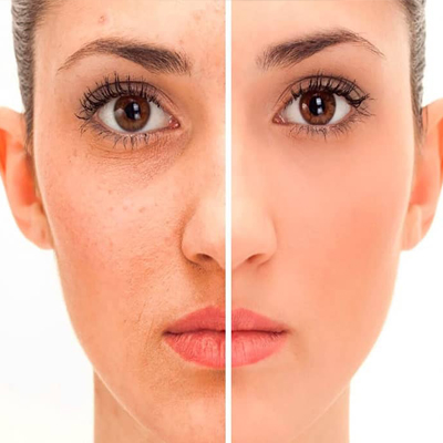 جوانسازی با ليزر YouLaser Image