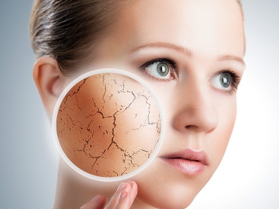 پيشگيری و درمان خشكی پوست