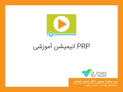 انیمیشن آموزشی PRP