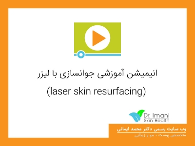 انیمیشن آموزشی جوانسازی با لیزر (laser skin resurfacing)