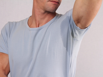 هایپر هیدروزیس یا تعریق شدید